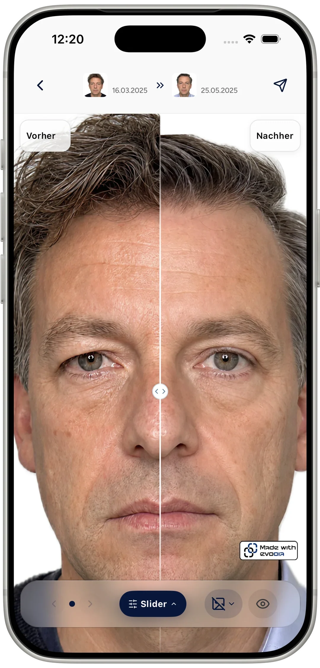 evooia App: Vorher/Nachher (Hautbild)
