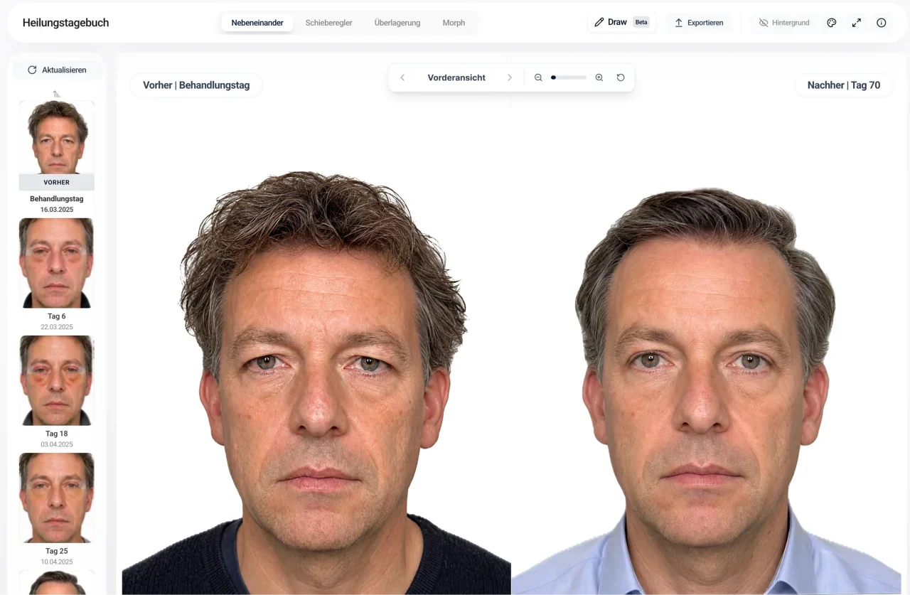 evooia Web Dashboard: Hautbild
