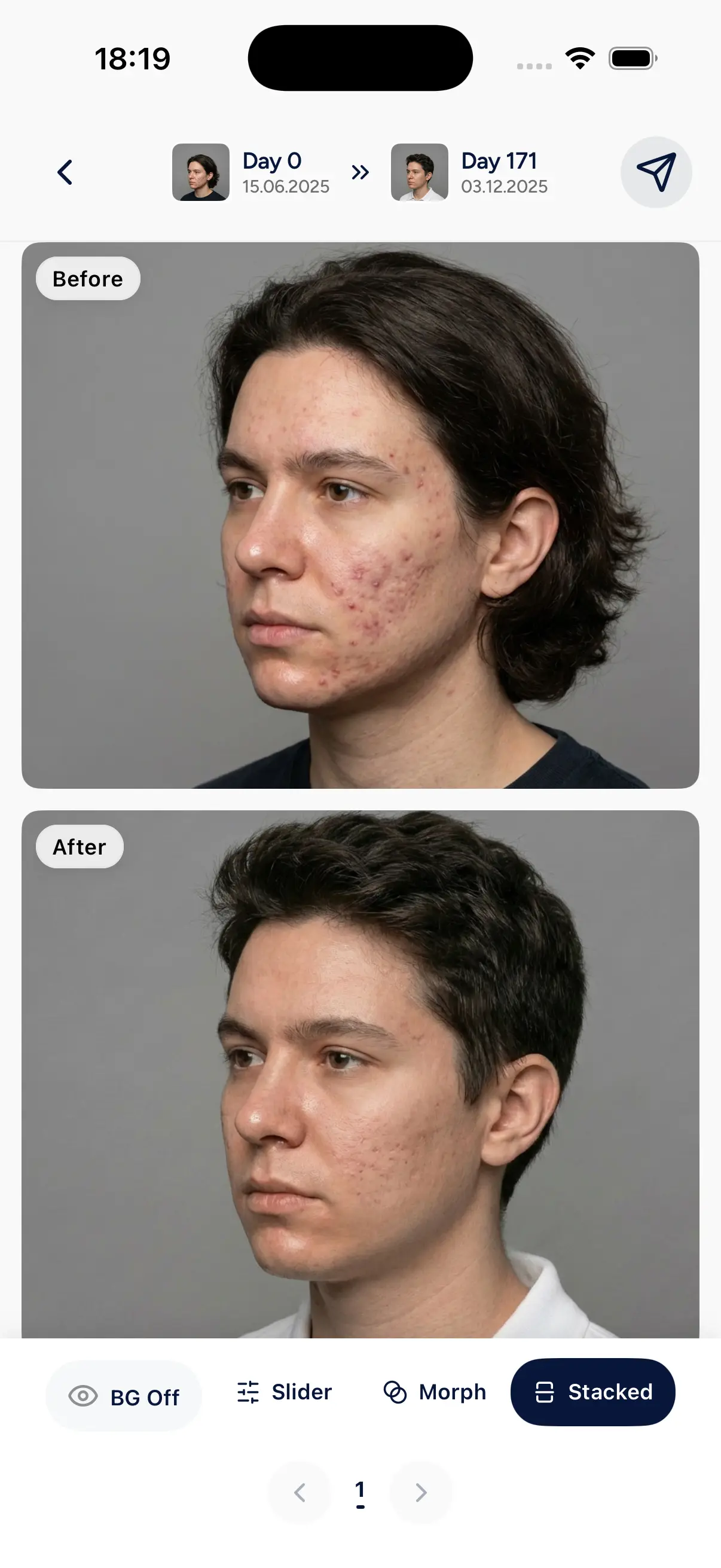Patient app slider preview