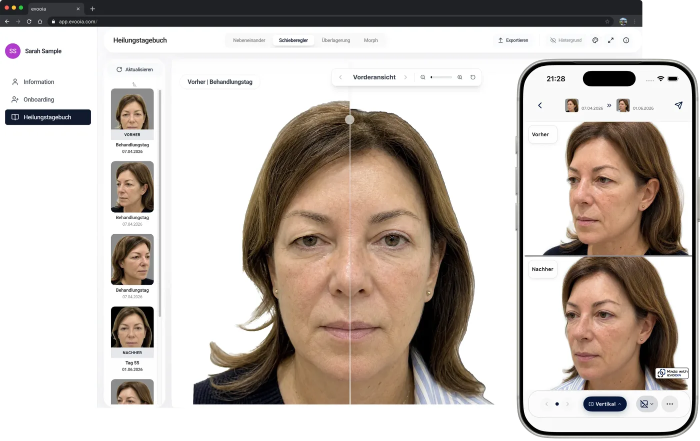 Das evooia-Web-Dashboard mit einer Ausgangsaufnahme und späteren Aufnahmen im Verlauf, daneben die synchronisierte Mobile-App
