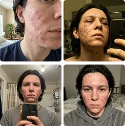 Inconsistent,
hard to assess